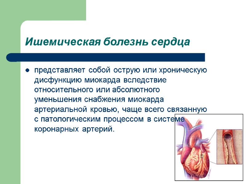 Ишемическая болезнь сердца  представляет собой острую или хроническую дисфункцию миокарда вследствие относительного или